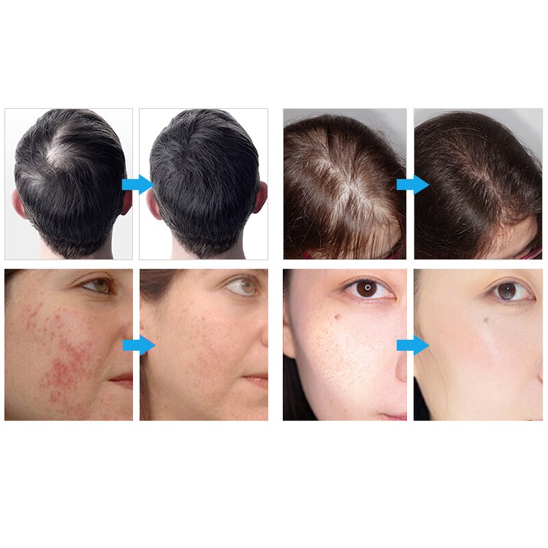 7 in 1 Hair Care Machine - Newest LED Light Galvanic Wand Brush Scalp Regrowth