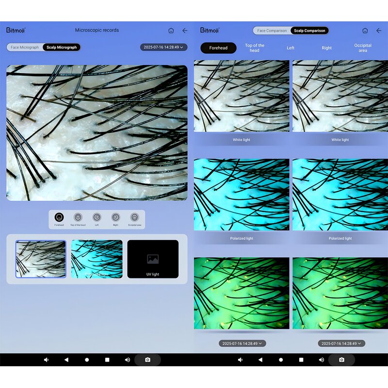 2in1 Skin Scalp Scanner - 2025 Newest OEM 3D AI Analyzer with 18 Languages