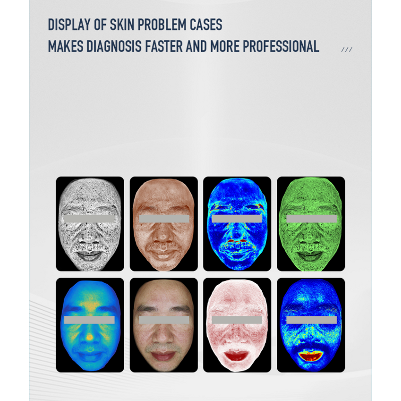 2in1 Skin Scalp Scanner - 2025 Newest OEM 3D AI Analyzer with 18 Languages