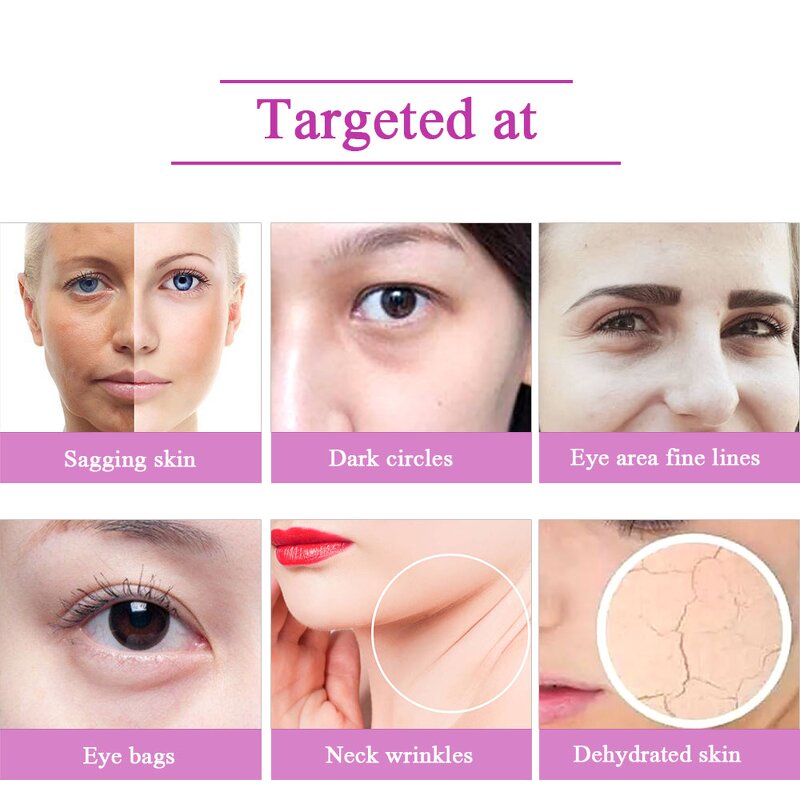 RF LED Eye Massager - Electric Eye Relax Bag Removal Electronic Vision Device