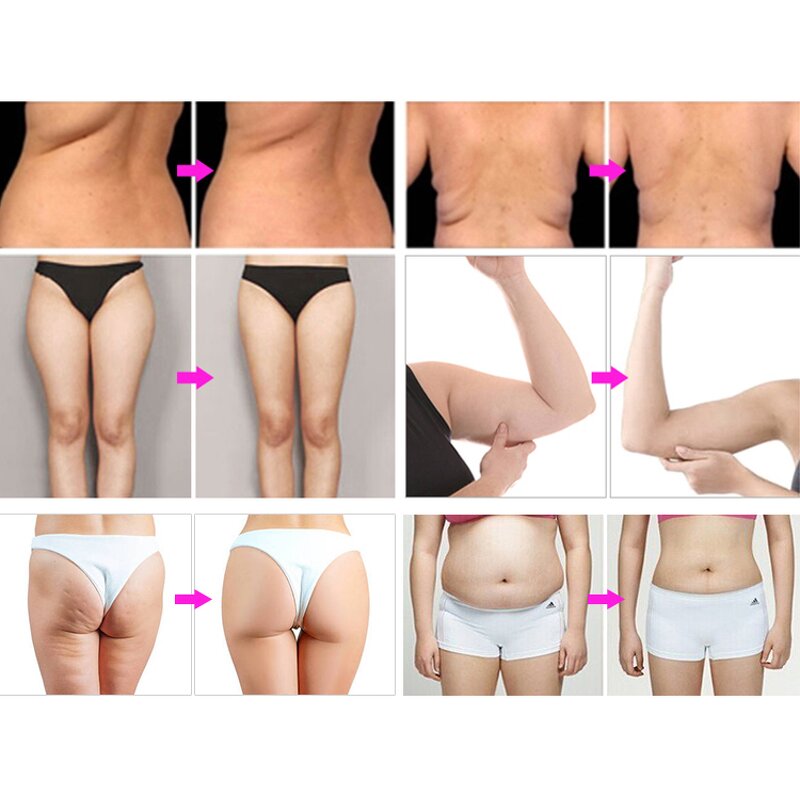 6 in 1 Cavitation Machine - Tuying Factory Price 80k Ultrasound Fat Burning