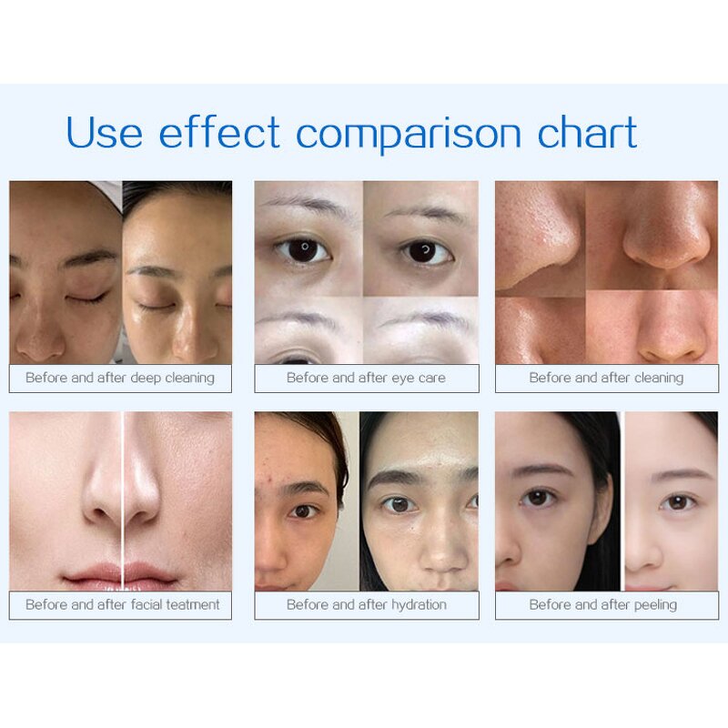 14in1 Hydra Dermabrasion - Professional Spa Korean H2o2 Bubble Facial Machine