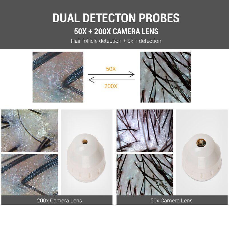 Scalp Hair Analyzer - Desktop Follicle Detector 10-inch HD 2 Probes Facial Scanner
