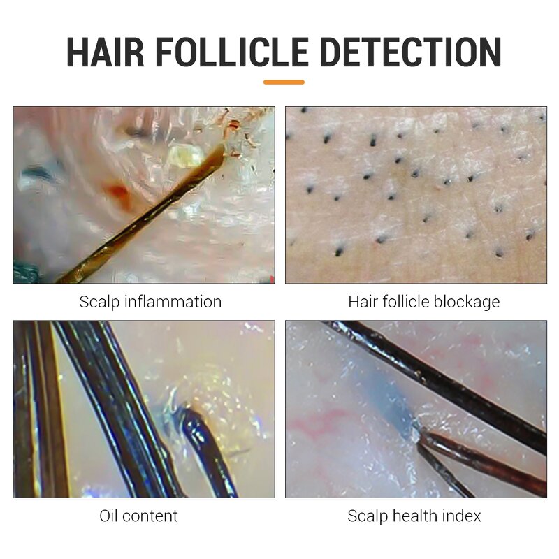 Hair Scalp Analyzer - Hot Sales Desktop Machine for Home and Salon Use