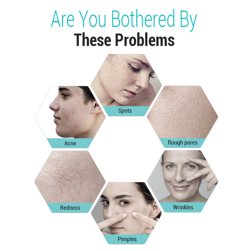 7 Color LED Light Therapy Machine - Professional Salon Facial PDT Beauty Device