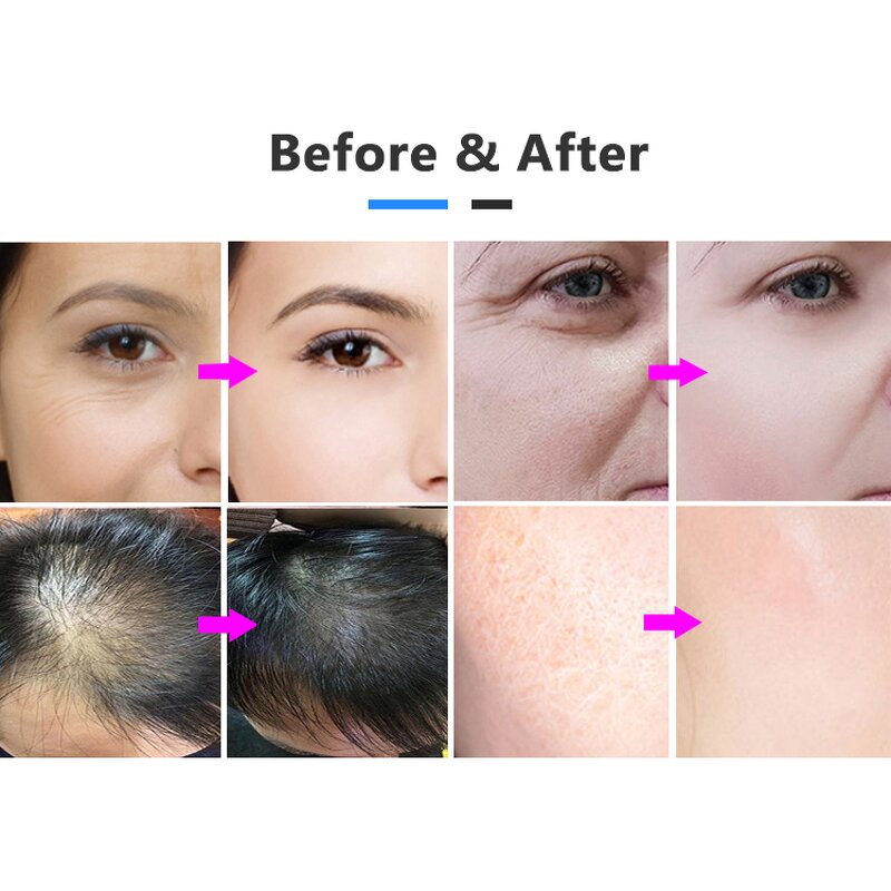 Mesogun Device - Injection Nano EMS RF Needle-free Mesotherapy Pressure Machine