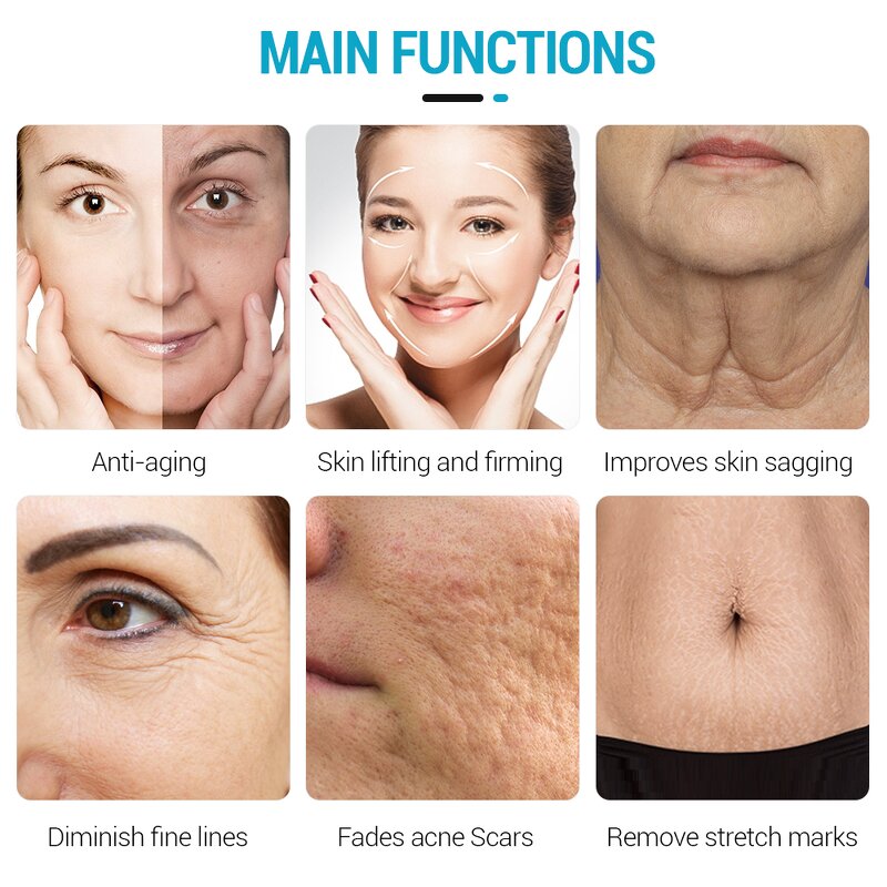 RF Microneedling Machine - Portable Scar Acne Eraser Gold Fractionated Device