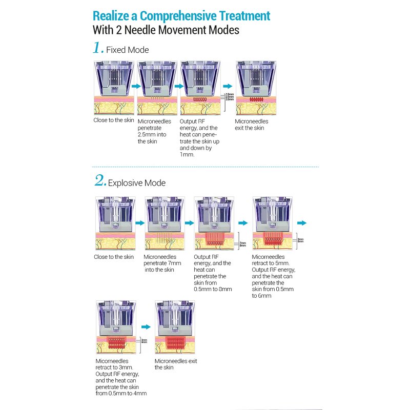 Gold Microneedle Machine - Newest Fractionated Radiofrequency Stretch Mark Removal