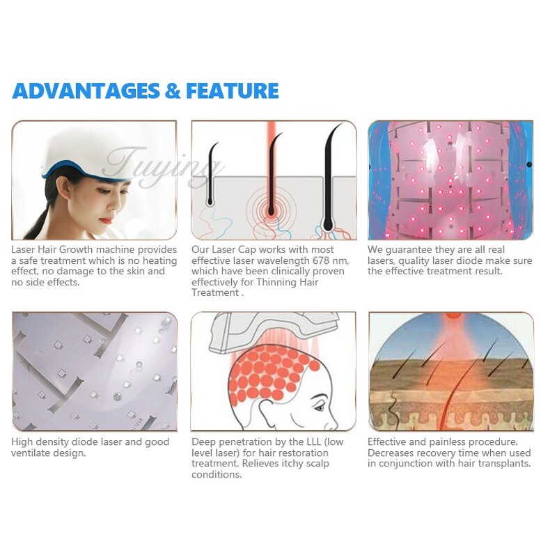 LED Hair Regrowth Helmet - Red Light Anti Hair Loss Treatment with 80 Diodes