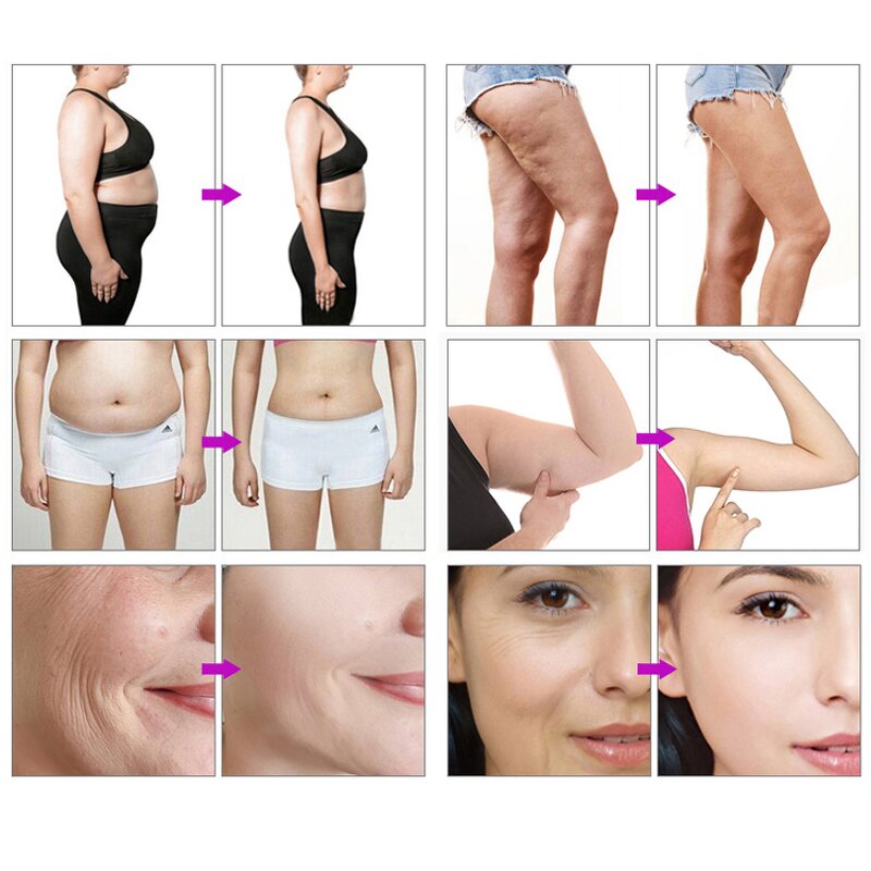 M30 Vela Machine - 2023 Professional Body Shape Vacuum Roller Slimming System