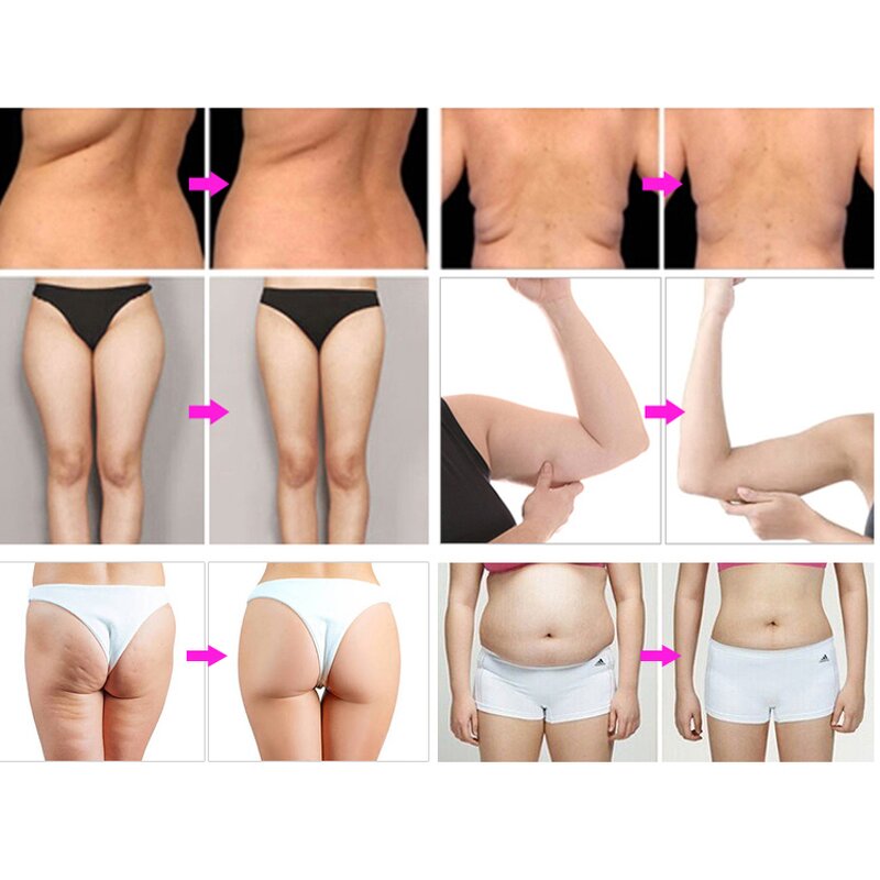 3 in 1 Pressotherapy Machine - Hot Sales Professional Lymphatic Drainage Weight Loss