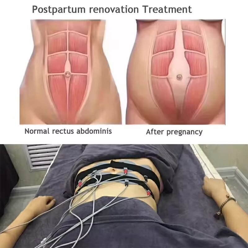 Muscle Stimulator Machine Manufacturer - AURO Portable Pro Electronic for Breast & Weight Loss