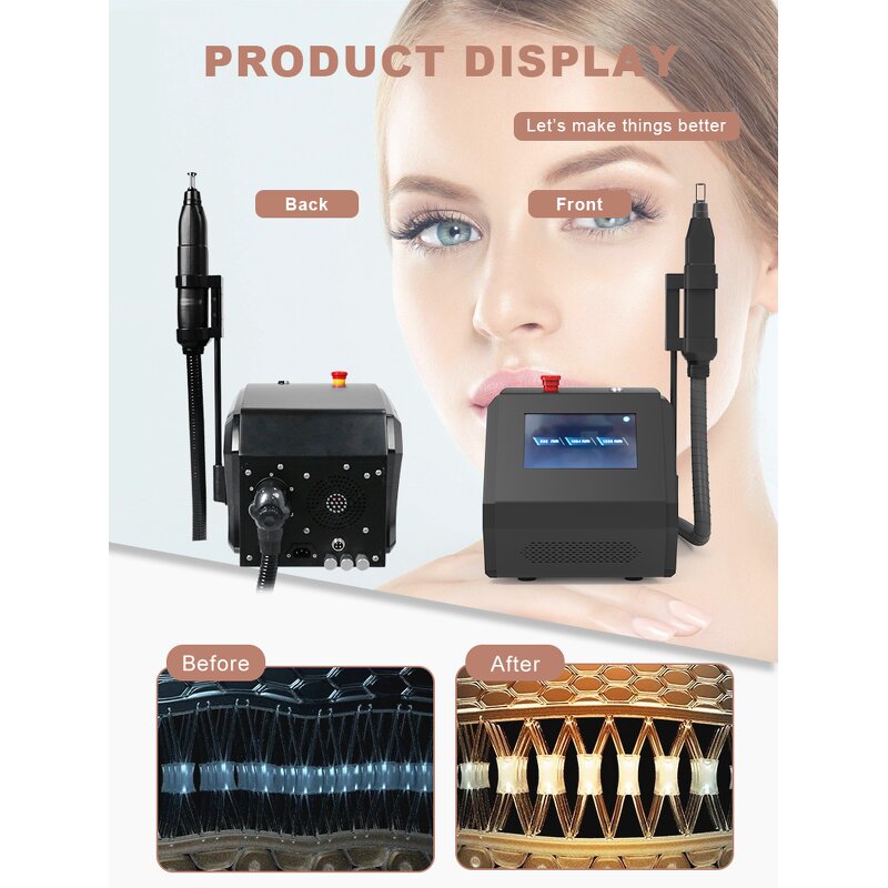 Laser Tattoo Removal Machine Manufacturer - Portable ND YAG Black Porcelain