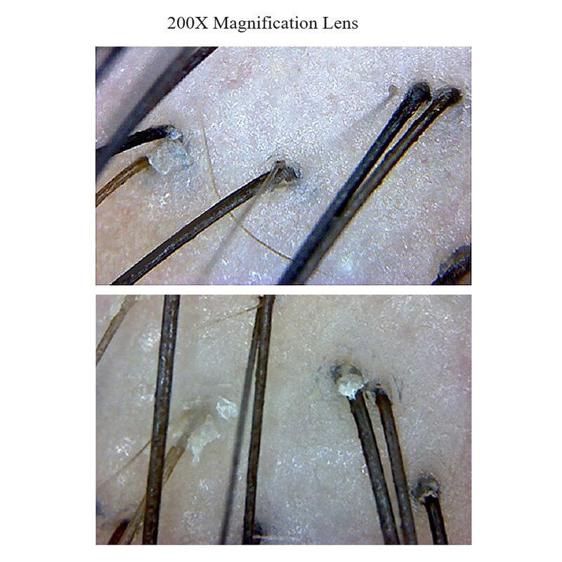 Skin Hair Analyzer Manufacturer - AU-958C Home Use for Analysis & Test