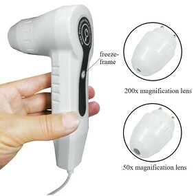 Hair Scanner Manufacturer - High-Precision for Scalp Follicle Health Assessment