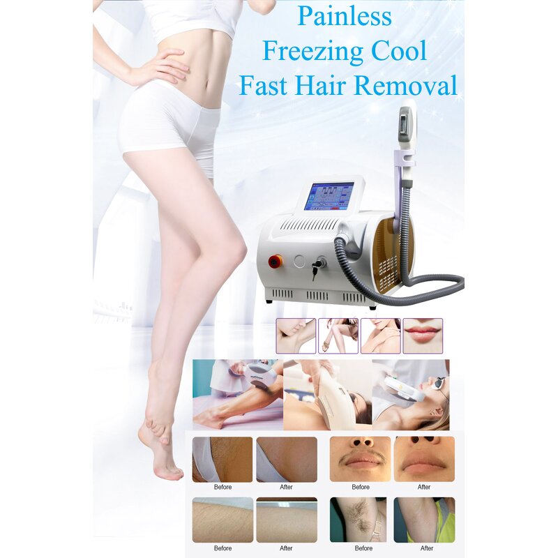 Hair Removal Equipment Manufacturer - Portable Professional OPT Skin Rejuvenation