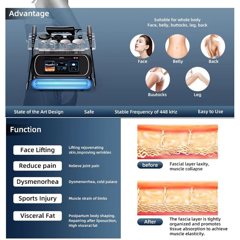 RF Equipment Manufacturer - Portable 448kHz Monopolar for Face Lifting & Body Shaping