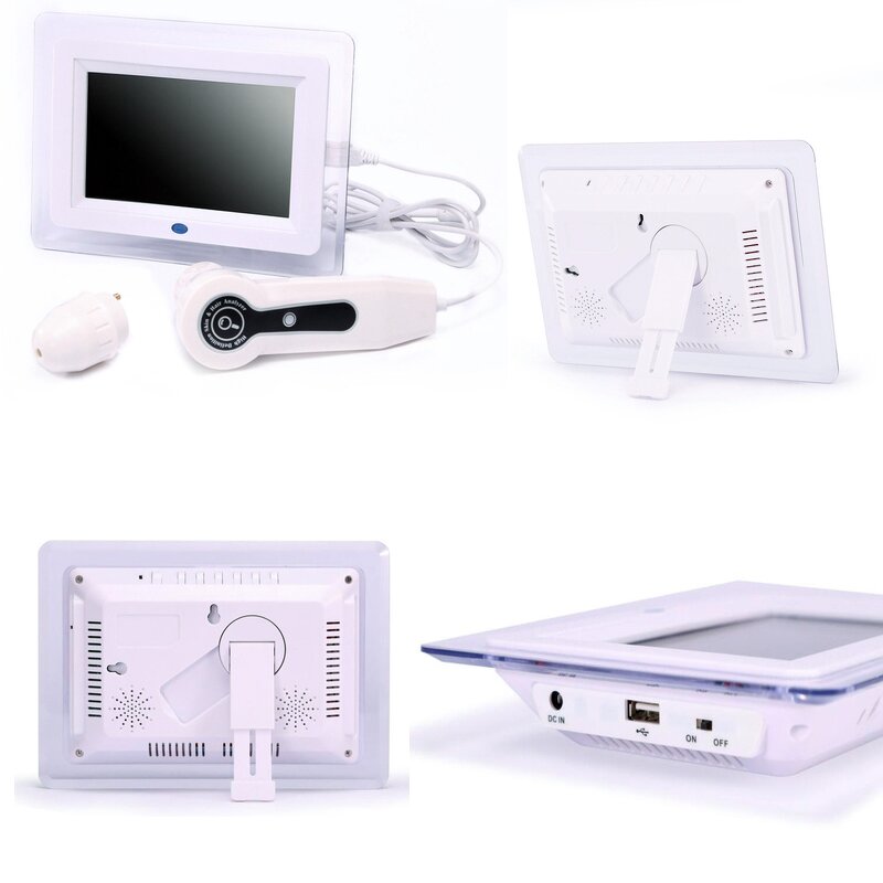 Skin and Hair Analyzer Manufacturer - AURO Portable 7 Inch with 50X and 200X Lens