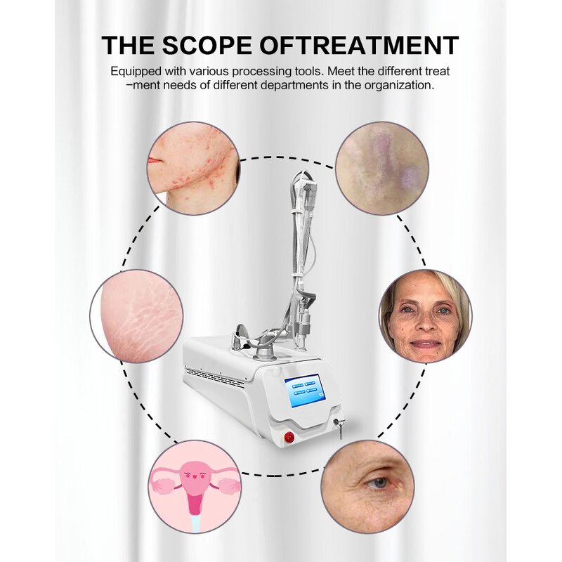 CO2 Laser Machine Manufacturer - Portable Fractional for Skin Tags & Scars
