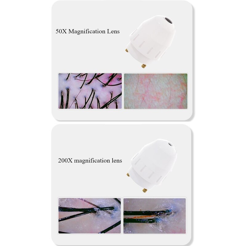 Skin and Hair Analyzer Manufacturer - AURO Portable 7 Inch with 50X and 200X Lens