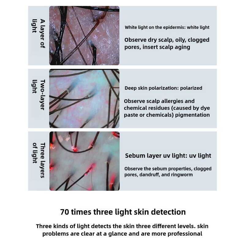 Skin and Hair Analyzer Manufacturer - AURO Portable with 70X and 200X Lens