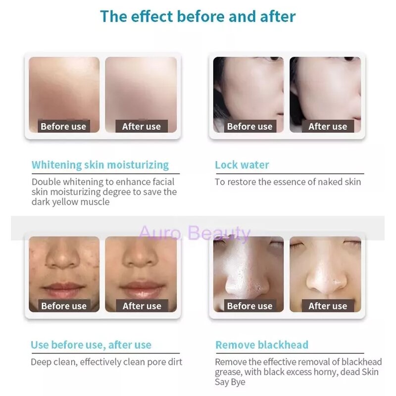 Hydro Dermabrasion Machine Manufacturer - Multifunctional Oxygen Bubble Facial Skin Hydro Jet