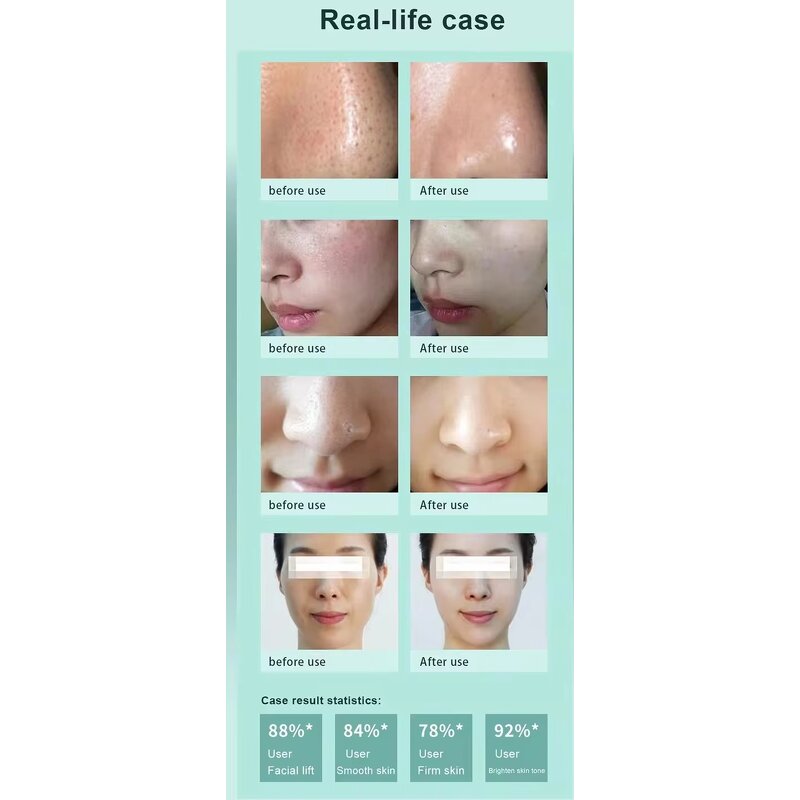 Hydrodermabrasion Machine Manufacturer - AU-S501 Salon Use 6 in 1 360° Visual