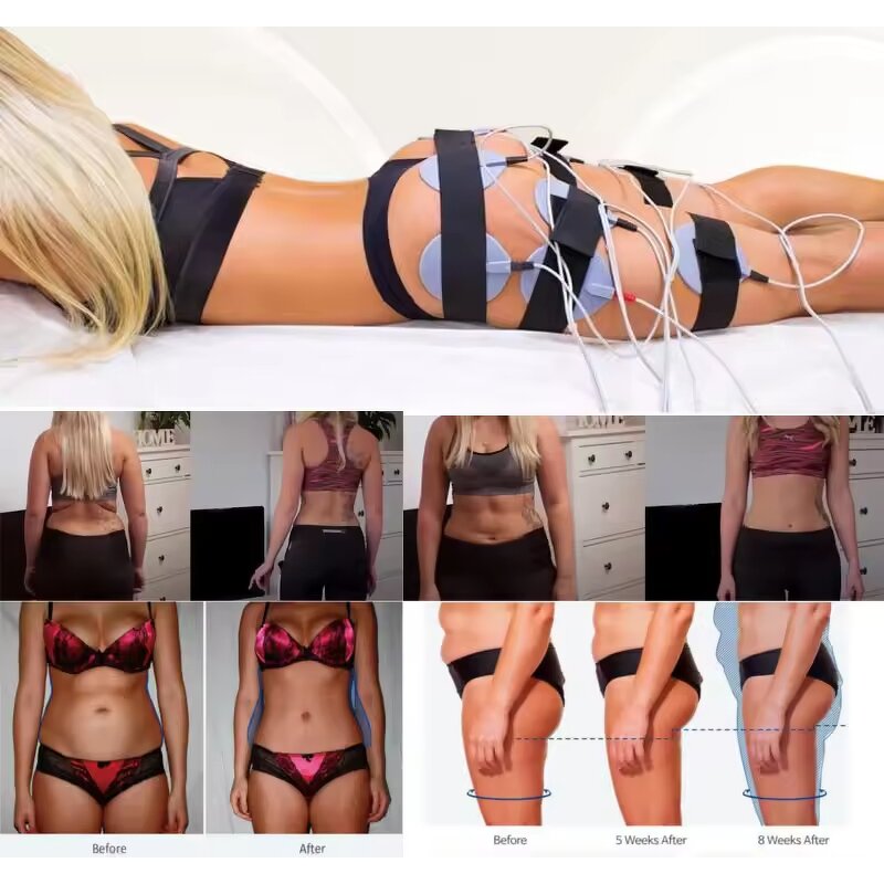 Electro Stimulation Equipment Manufacturer - for Muscle Tightening Weight Loss & Breast Enhancement
