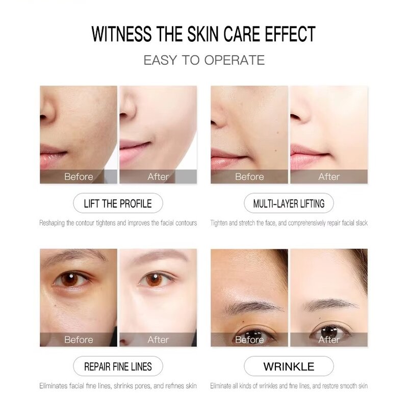 Facial Spa Machine Manufacturer - AURO 4 in 1 V-Max Wrinkle Remover & Oxygen Jet