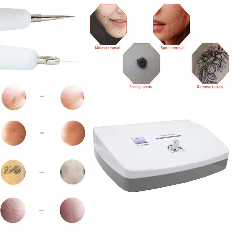 Cautery Machine Manufacturer - Professional for Wart & Black Spot Removal Portable