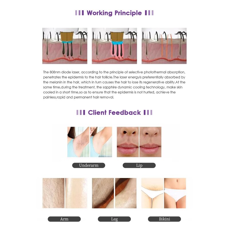 Laser Hair Removal Machine Manufacturer - Standing 808 Diode & ND Yag