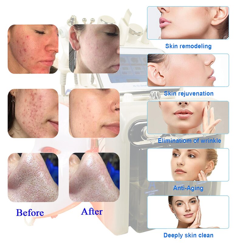 Facial Care Device Manufacturer - H2O2 New 7 in 1 Multifunctional for Skin Care