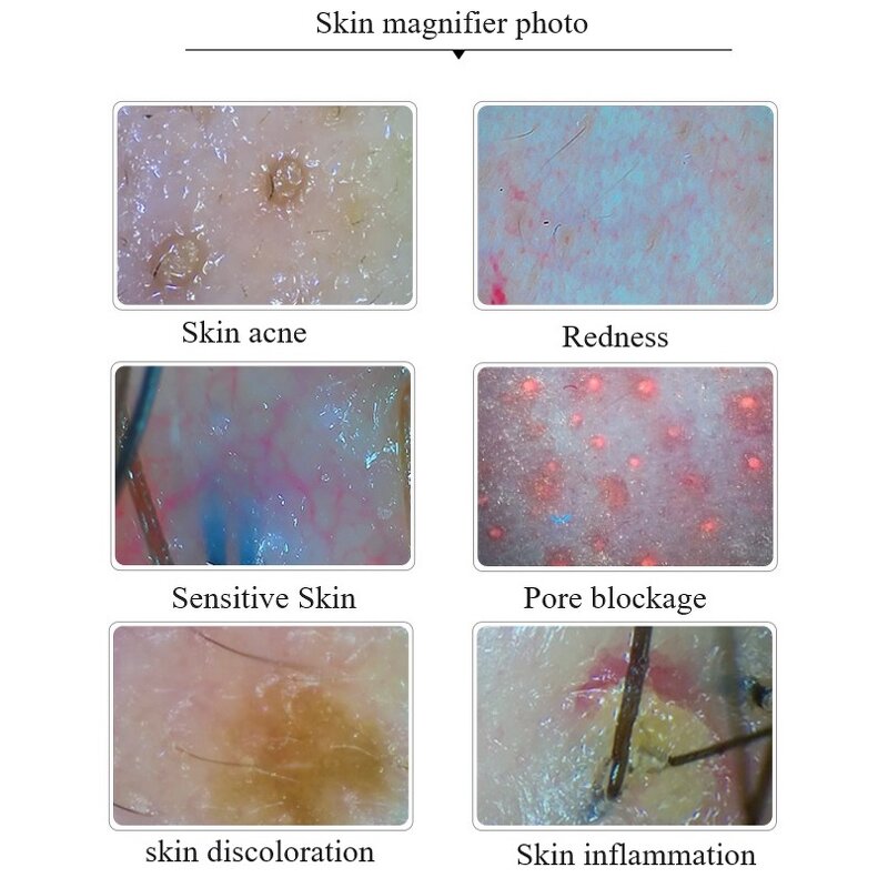 Hair Scanner Manufacturer - High-Precision for Scalp Follicle Health Assessment