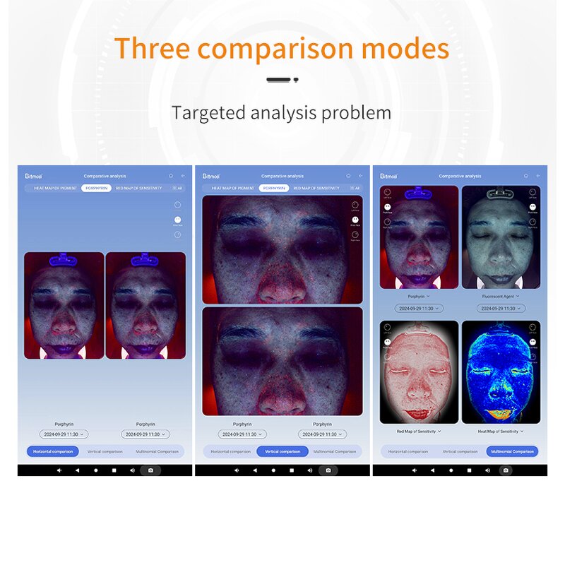 Skin Analyzer Machine Manufacturer - AURO AI Intelligent Digital 36 Million Pixels