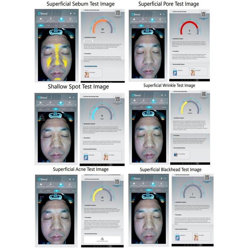 AI Skin Analyzer Manufacturer - AU-998B Salon Use Large Touch Screen 28 Million Pixel