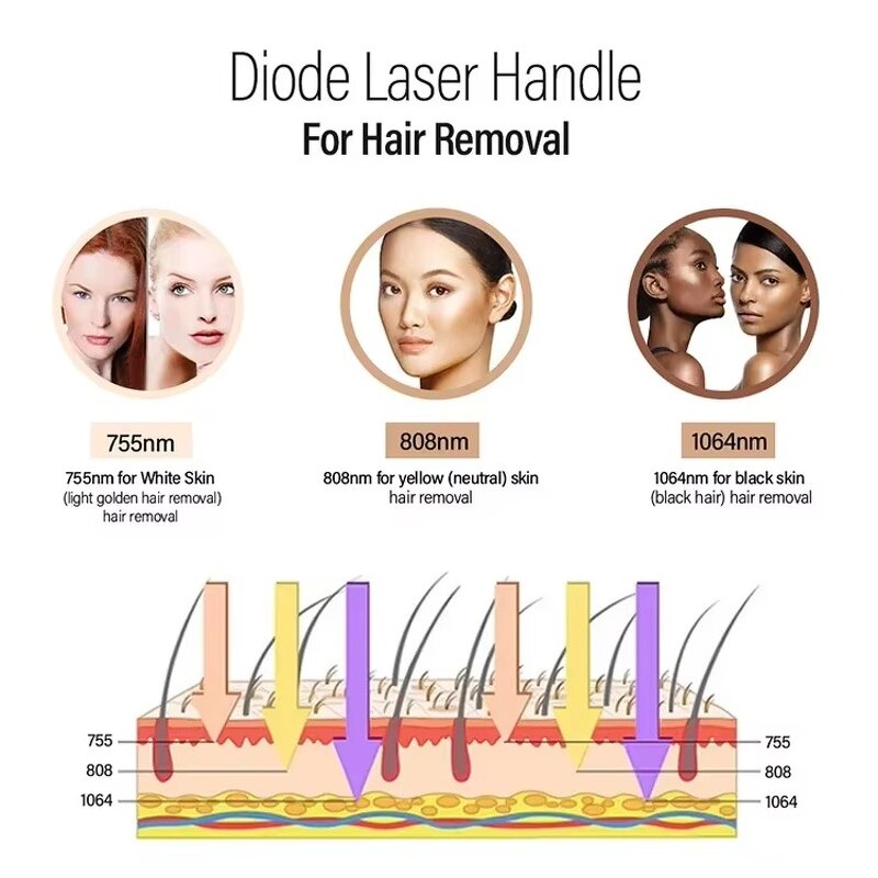 Diode Laser Hair Removal Machine Manufacturer - Desktop 808nm with Super Cooling