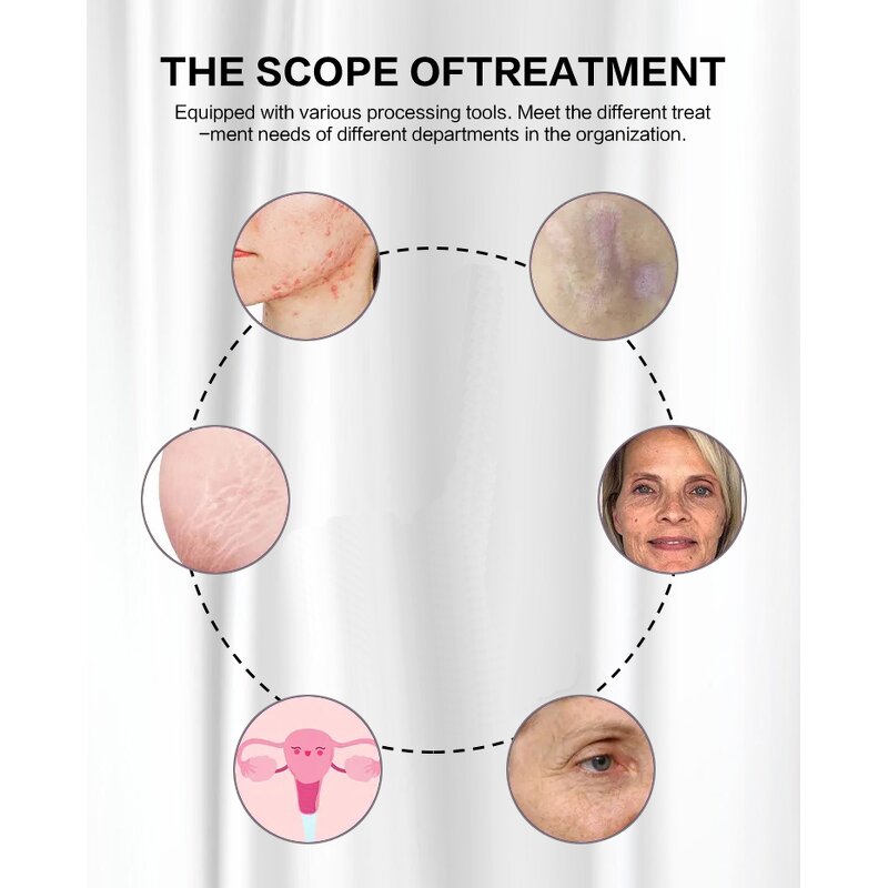 Fractional Laser Machine Manufacturer - Professional CO2 for Stretch Marks & Acne