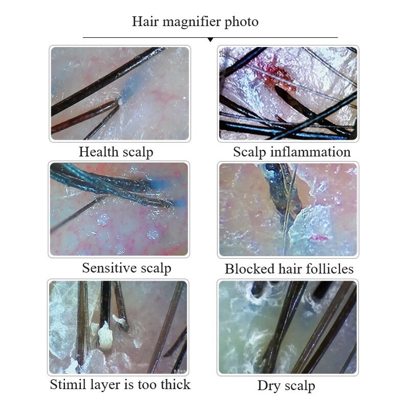 Skin and Hair Analyzer Manufacturer - AURO Portable 7 Inch with 50X and 200X Lens