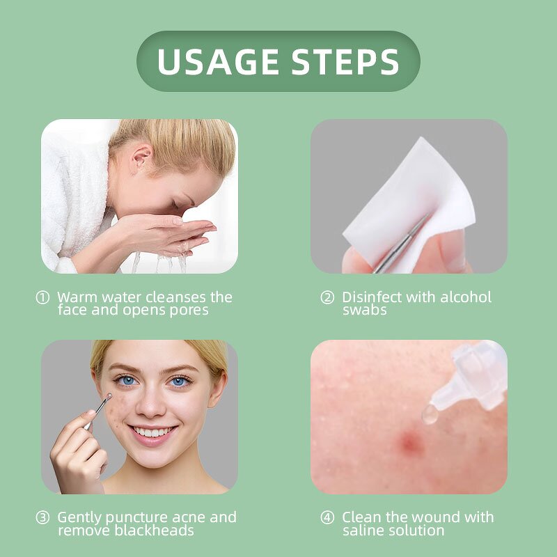 Pimple Extractor Kit - Hot Sale 4pcs Stainless Steel Acne Blackhead Blemish Needle