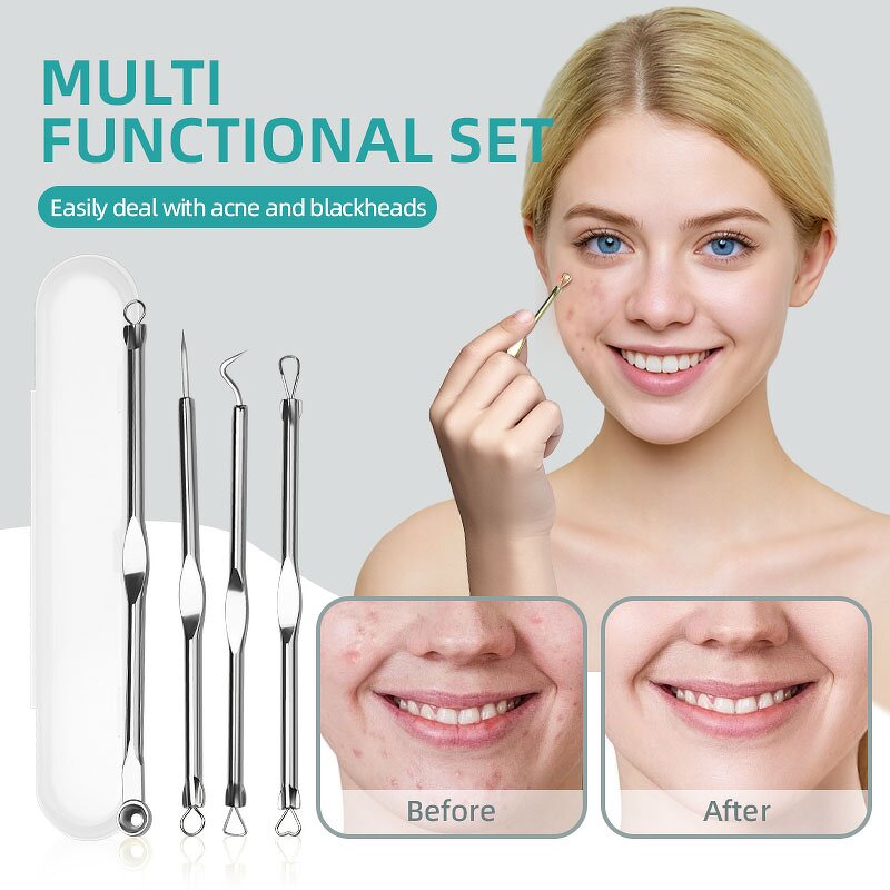 Pimple Extractor Kit - Hot Sale 4pcs Stainless Steel Acne Blackhead Blemish Needle