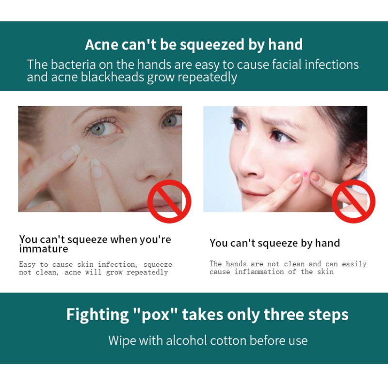 Acne Needle Factory - High Quality Comedone Extractor Tools