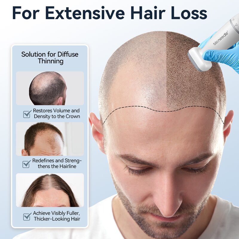 Derma Stamp Manufacturer - Bio Needle 120 Pins Adjustable Needle Length