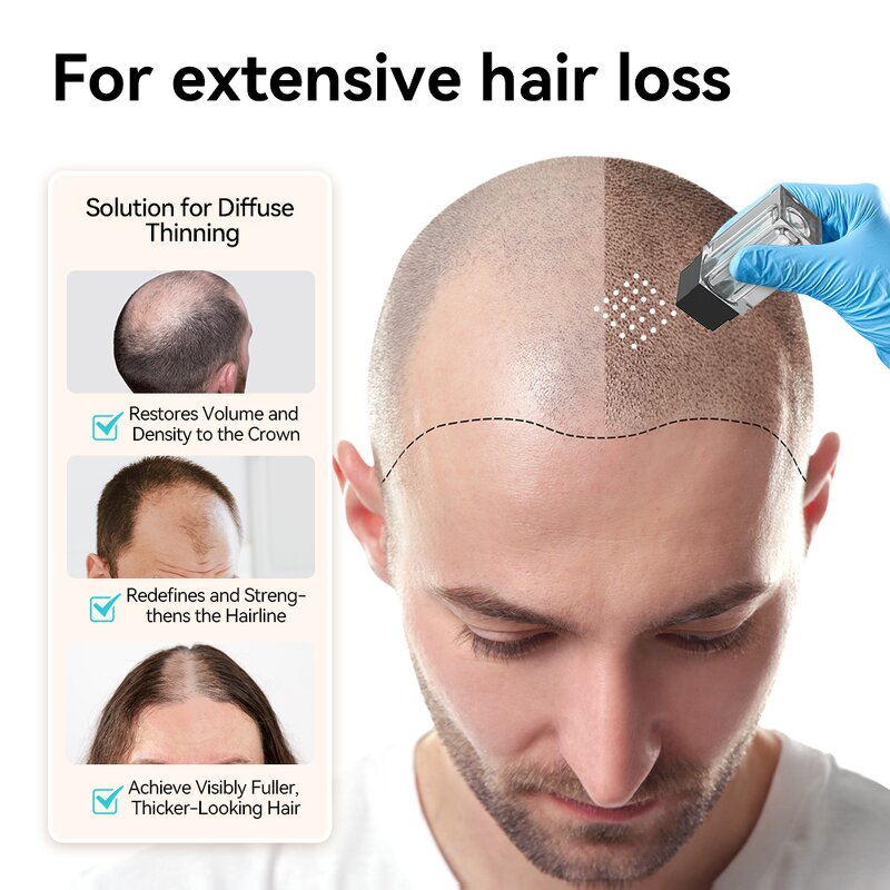 Beauty Device Manufacturer - Hydra Needle 25 Portable Serum Carrier Titanium