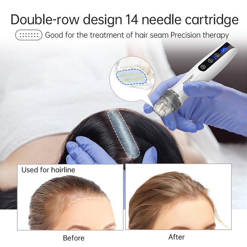 Derma Pen Manufacturer - Q2 Microneedle for Facial Skincare