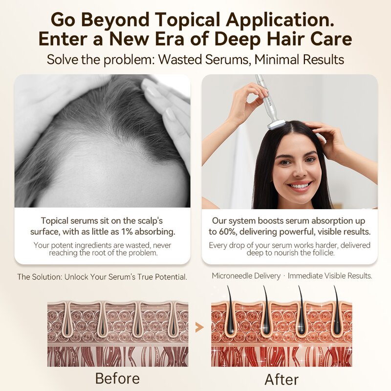 Derma Stamp Manufacturer - Bio 4 Customizable for Acne Treatment Titanium