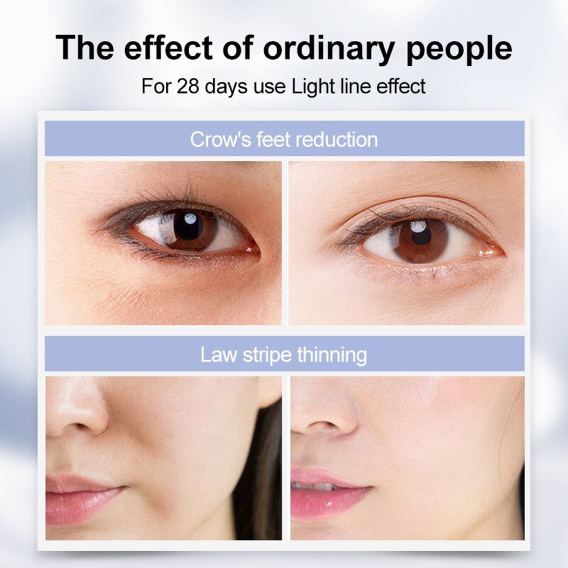 Skincare Eye Wand - 28 Days Rejuvenation EMS Red Light Heat Therapy Eye Massager