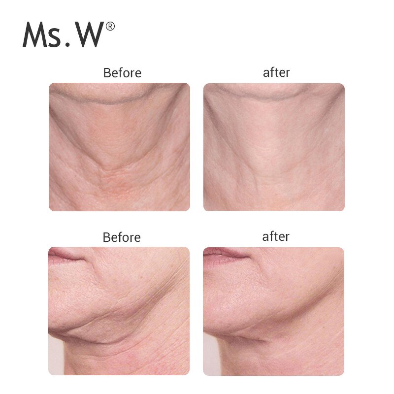 Face Neck Lifting Device - Blue Red Light Therapy Rechargeable Beauty Boost Tool