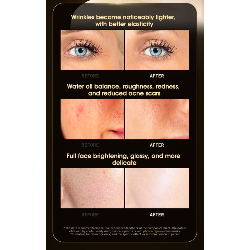 8-Light Silicone LED Mask - Red Blue Light Acne Treatment Whitening Anti-Aging