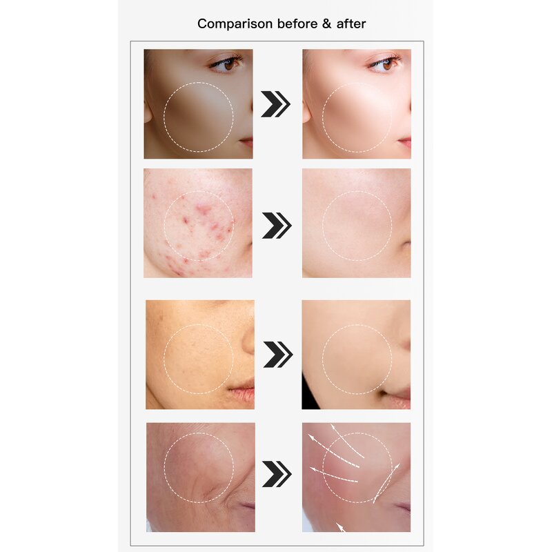 LED Light Therapy Mask - Blue Infrared Red Anti-Aging Skincare Facial Rejuvenation Device