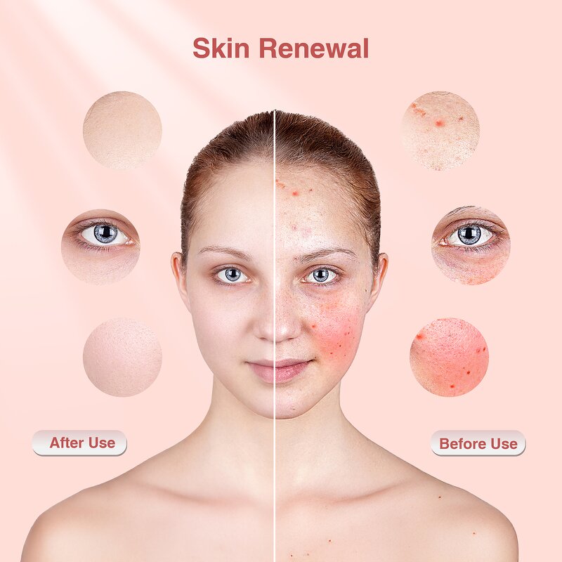 PDT LED Light Therapy Panel - Most Popular Red Light Facial Mask Device